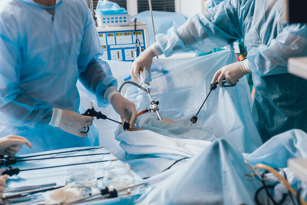 ¿Qué es la cirugía laparoscópica?